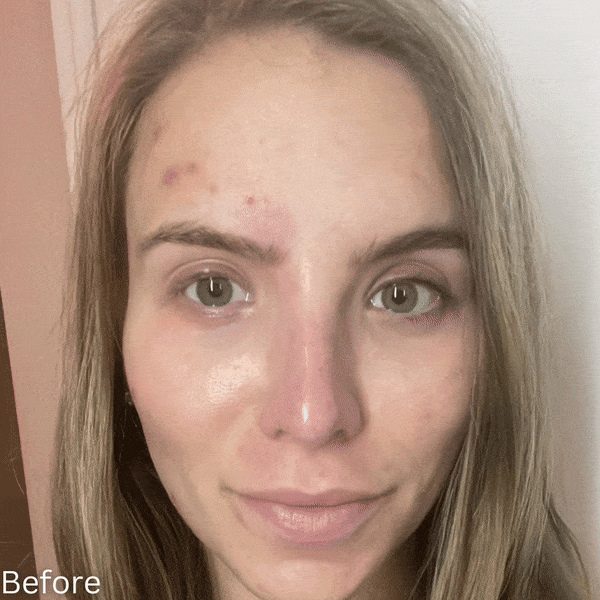 Kenseli Glow Pads