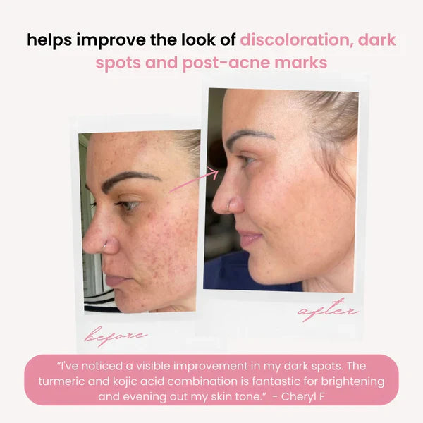 Kenseli Glow Pads